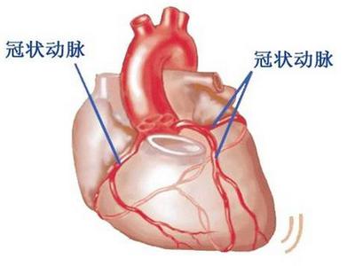 冠心病吃什么药物治疗