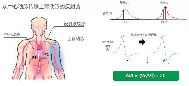 什么是心血管健康指标AVI API